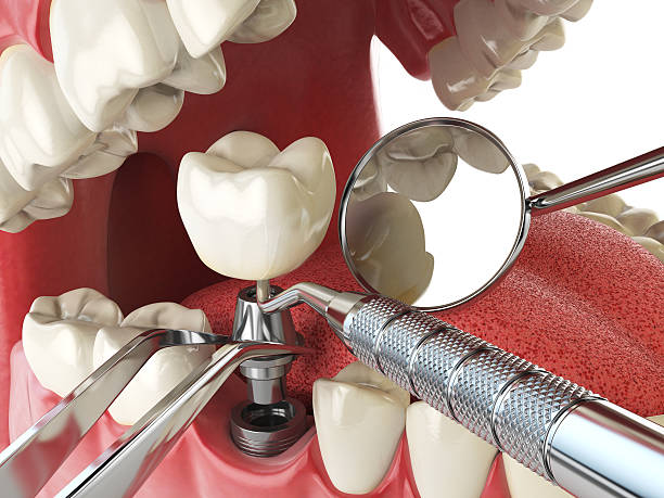 Best Emergency Denture Repair in Ramseur, NC